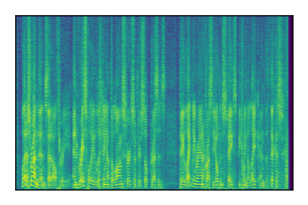An audio spectrogram.