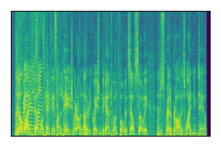 An audio spectrogram.