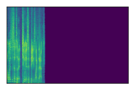 An audio spectrogram.