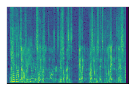 An audio spectrogram.