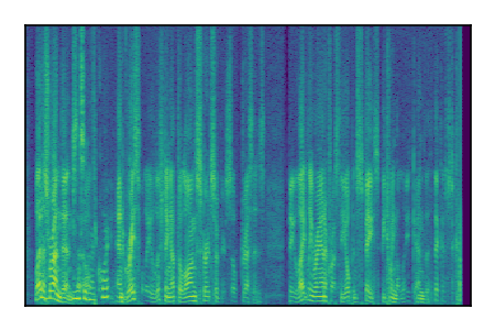 An audio spectrogram.