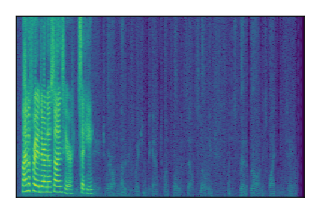 An audio spectrogram.