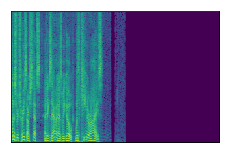 An audio spectrogram.