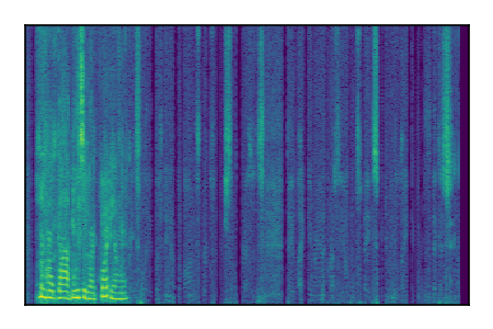 An audio spectrogram.