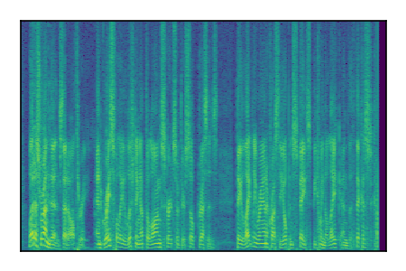 An audio spectrogram.