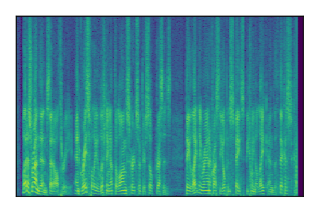 An audio spectrogram.