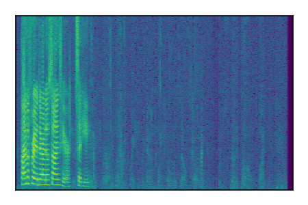 An audio spectrogram.