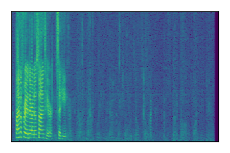 An audio spectrogram.