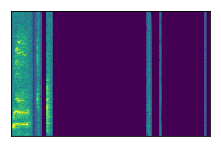 An audio spectrogram.