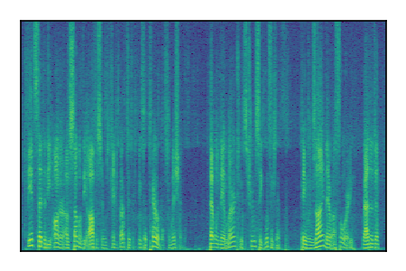 An audio spectrogram.