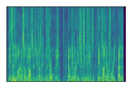 An audio spectrogram.