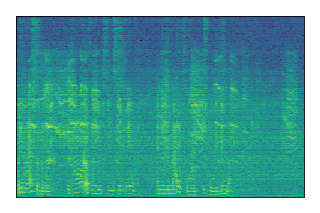 An audio spectrogram.