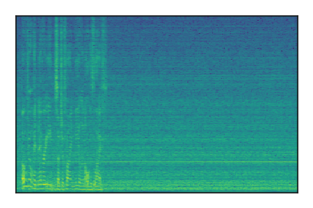 An audio spectrogram.