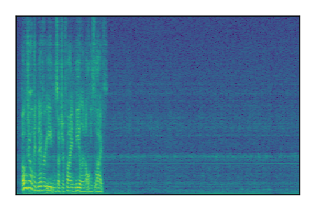 An audio spectrogram.