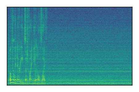 An audio spectrogram.