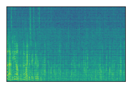 An audio spectrogram.