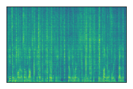 An audio spectrogram.
