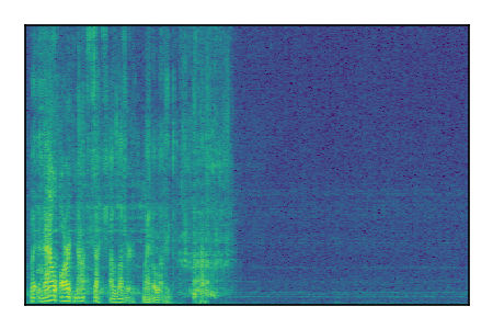 An audio spectrogram.