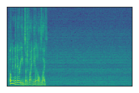 An audio spectrogram.