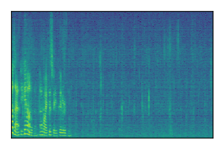 An audio spectrogram.