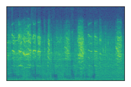 An audio spectrogram.