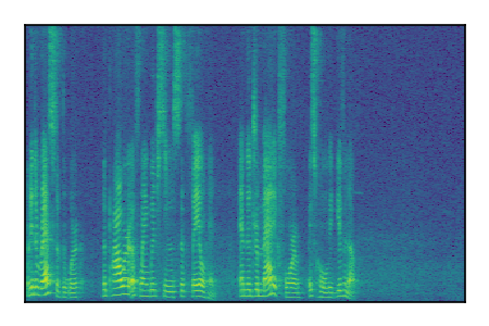 An audio spectrogram.