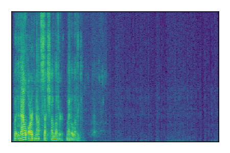 An audio spectrogram.