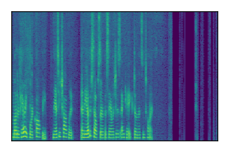 An audio spectrogram.