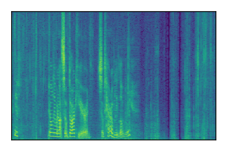 An audio spectrogram.
