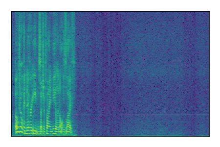 An audio spectrogram.