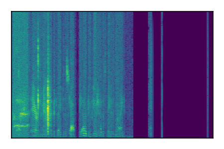 An audio spectrogram.