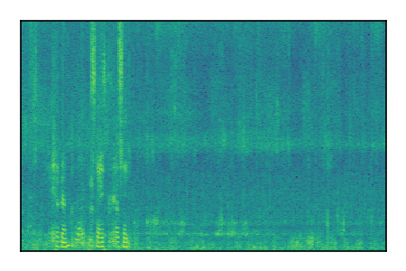 An audio spectrogram.