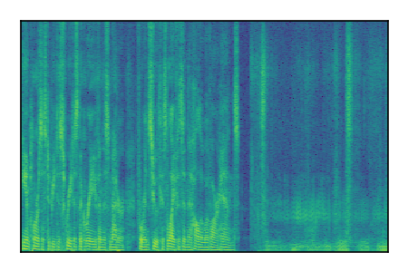 An audio spectrogram.